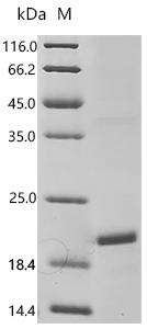 Human Thyrotropin subunit beta (TSHB) Recombinant Protein, Homo sapiens (Human), E.coli, C-terminal 6xHis-tagged, 19.8 kDa, purity >≥ 90% as determined by SDS-PAGE.