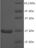 Mouse Normal mucosa of esophagus-specific gene 1 protein (Nmes1) Recombinant Protein, N-His-SUMO - BioCrest Sci