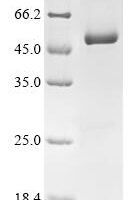 Human Transcriptional enhancer factor TEF-1 (TEAD1) Recombinant Protein, Tag-Free - BioCrest Sci