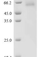 Human 1-acylglycerol-3-phosphate O-acyltransferase PNPLA3 (PNPLA3)(I148M) Recombinant Protein - BioCrest Sci