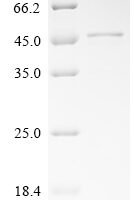 Mouse Tolloid-like protein 2 (Tll2), partial Recombinant Protein, C-His, aa 146–346, Yeast - BioCrest Sci