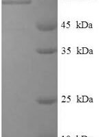 Rotavirus A Intermediate capsid protein VP6 Recombinant Protein, N-His-SUMO - BioCrest Sci