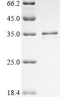Human Ras-related protein Rab-12 (RAB12) Recombinant Protein, C-His - BioCrest Sci