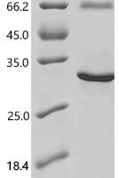 Human Sclerostin domain-containing protein 1 (SOSTDC1) Recombinant Protein, N-His - BioCrest Sci