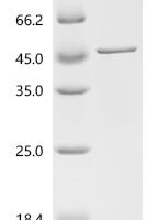 Mouse Nischarin (Nisch), partial Recombinant Protein - BioCrest Sci