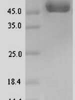 Human Draxin (DRAXIN) Recombinant Protein - BioCrest Sci
