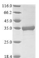 Thermotoga maritima 5-keto-L-gluconate epimerase (iolO) Recombinant Protein - BioCrest Sci