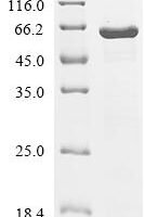 Escherichia coli Translation initiation factor IF-2 (infB), partial Recombinant Protein - BioCrest Sci