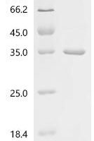 Francisella tularensis subsp LPS-assembly protein lptD (lptD), partial Recombinant Protein - BioCrest Sci