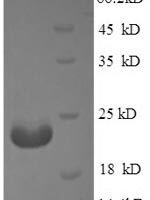 Mouse Adiponectin (Adipoq), partial Recombinant Protein - BioCrest Sci