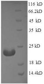 Mouse Adiponectin (Adipoq), partial Recombinant Protein, Mus musculus (Mouse), E.coli, N-terminal 6xHis-tagged, 20.5 kDa, purity >≥ 90% as determined by SDS-PAGE.