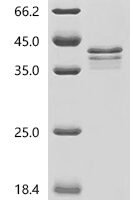 Mouse Placenta-expressed transcript 1 protein (Plet1) Recombinant Protein, N-His-SUMO - BioCrest Sci