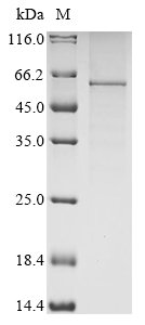 Human Leucine-rich glioma-inactivated protein 1 (LGI1) Recombinant Protein, N-10His/C-Myc, Homo sapiens (Human), Baculovirus, N-terminal 10xHis-tagged and C-terminal Myc-tagged, 63.9 kDa, purity >≥ 85% as determined by SDS-PAGE.