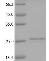 Human Kita-kyushu lung cancer antigen 1 (CT83) Recombinant Protein, N-His-tagged/Tag-Free - BioCrest Sci