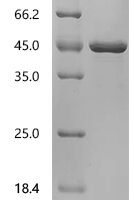 Human Titin (TTN), partial Recombinant Protein, C-His, aa 14257–14543 - BioCrest Sci