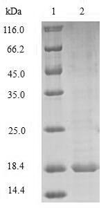 Mouse Prion-like protein doppel (Prnd) Recombinant Protein, Mus musculus(Mouse), Baculovirus, N-terminal 10xHis-tagged and C-terminal Myc-tagged, 18.9 kDa, purity >≥ 85% as determined by SDS-PAGE.
