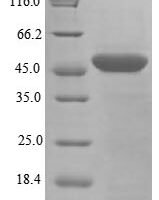 Human Parkinson disease protein 7 (PARK7), partial Recombinant Protein, N-His-GST - BioCrest Sci