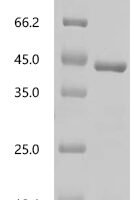 Human Soluble calcium-activated nucleotidase 1 (CANT1), partial Recombinant Protein, C-His - BioCrest Sci