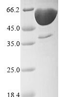 Human Delta-like protein 3 (DLL3), partial Recombinant Protein, N-His - BioCrest Sci
