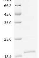 Macaca fascicularis Macaca fascicularis brain cDNA clone: QorA-11660, similar to human lymphocyte antigen 6 complex, locus E (LY6E), mRNA, RefSeq: NM_002346.1 Recombinant Protein, C-His - BioCrest Sci