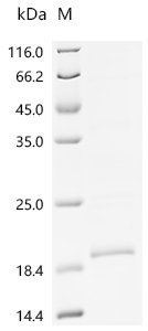 Macaca fascicularis Macaca fascicularis brain cDNA clone: QorA-11660, similar to human lymphocyte antigen 6 complex, locus E (LY6E), mRNA, RefSeq: NM_002346.1 Recombinant Protein, C-His, Macaca fascicularis (Crab-eating macaque) (Cynomolgus monkey), E.coli, C-terminal 6xHis-tagged, 18.3 kDa, purity >≥ 85% as determined by SDS-PAGE.