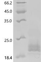 Human Calcitonin gene-related peptide 2 (CALCB), partial Recombinant Protein, N-His-SUMOstar - BioCrest Sci