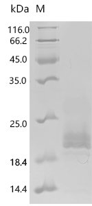 Human Calcitonin gene-related peptide 2 (CALCB), partial Recombinant Protein, N-His-SUMOstar, Homo sapiens (Human), Yeast, N-terminal 6xHis-sumostar-tagged, 16.9 kDa, purity >≥ 85% as determined by SDS-PAGE.