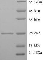 Human Vesicle-associated membrane protein 7 (VAMP7), partial Recombinant Protein - BioCrest Sci