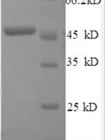 Human Interferon beta (IFNB1) Recombinant Protein, N-GST - BioCrest Sci