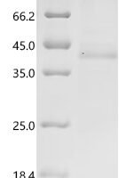Human herpesvirus 6A Immediate-early protein 1 (U90/U89), partial Recombinant Protein, C-His, aa 665–941, Baculovirus - BioCrest Sci