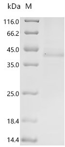 Human herpesvirus 6A Immediate-early protein 1 (U90/U89), partial Recombinant Protein, C-His, aa 665–941, Baculovirus, Human herpesvirus 6A (strain Uganda-1102) (HHV-6 variant A) (Human B lymphotropic virus), Baculovirus, C-terminal 6xHis-tagged, 40.0 kDa, purity >≥ 85% as determined by SDS-PAGE.