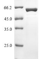 Human IgA-inducing protein homolog (IGIP) Recombinant Protein, N-terminal?His-TF - BioCrest Sci