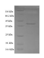 Human Calponin-3 (CNN3), partial Recombinant Protein - BioCrest Sci