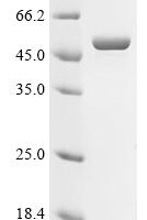Measles virus Fusion glycoprotein F0 (F), partial Recombinant Protein, N-10His/C-Myc - BioCrest Sci