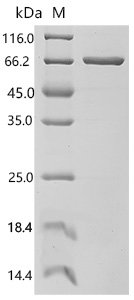 Human Acyl-CoA synthetase family member 2, mitochondrial(ACSF2) Recombinant Protein, Homo sapiens (Human), E.coli, C-terminal 6xHis-tagged, 70.7 kDa, purity >≥ 95% as determined by SDS-PAGE.