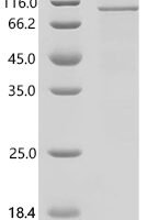 Human Toll-like receptor 2 (TLR2) Recombinant Protein - BioCrest Sci
