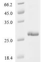 Human papillomavirus 11 Protein E6 (E6) Recombinant Protein, C-His - BioCrest Sci