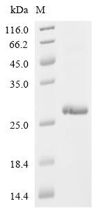 Human papillomavirus 11 Protein E6 (E6) Recombinant Protein, C-His, Human papillomavirus 11, E.coli, C-terminal 6xHis-tagged, 24.3 kDa, purity >≥ 95% as determined by SDS-PAGE.
