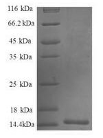 Human C-C motif chemokine 7 (CCL7) Recombinant Protein, N-His - BioCrest Sci