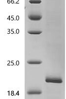 Human Histamine H4 receptor (HRH4), partial Recombinant Protein - BioCrest Sci