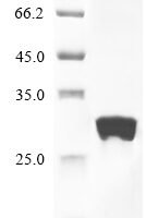 Human cytomegalovirus Envelope glycoprotein L (gL) Recombinant Protein, N-10His - BioCrest Sci