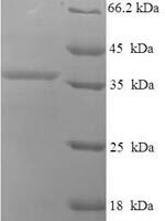 Human Uncharacterized protein C9orf163 (C9orf163) Recombinant Protein - BioCrest Sci