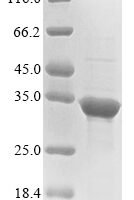 Human YjeF N-terminal domain-containing protein 3 (YJEFN3) Recombinant Protein - BioCrest Sci