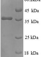 Human Heat shock factor-binding protein 1 (HSBP1), partial Recombinant Protein - BioCrest Sci