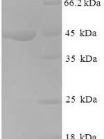 Human NADH dehydrogenase [ubiquinone] 1 alpha subcomplex subunit 6 (NDUFA6) Recombinant Protein - BioCrest Sci