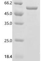 Mouse Kininogen-1 (Kng1) Recombinant Protein - BioCrest Sci