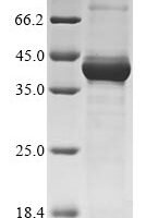 Human Maternal embryonic leucine zipper kinase (MELK), partial Recombinant Protein - BioCrest Sci