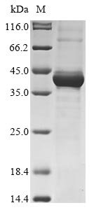 Human Maternal embryonic leucine zipper kinase (MELK), partial Recombinant Protein, Homo sapiens (Human), E.coli, N-terminal 10xHis-tagged and C-terminal Myc-tagged, 44.3 kDa, purity >≥ 85% as determined by SDS-PAGE.