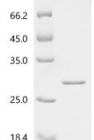 Human Retinoblastoma-associated protein (RB1), partial Recombinant Protein, C-His, aa 769–921 - BioCrest Sci