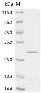Human Retinoblastoma-associated protein (RB1), partial Recombinant Protein, C-His, aa 769–921, Homo sapiens (Human), E.coli, C-terminal 6xHis-tagged, 24.0 kDa, purity >≥ 85% as determined by SDS-PAGE.